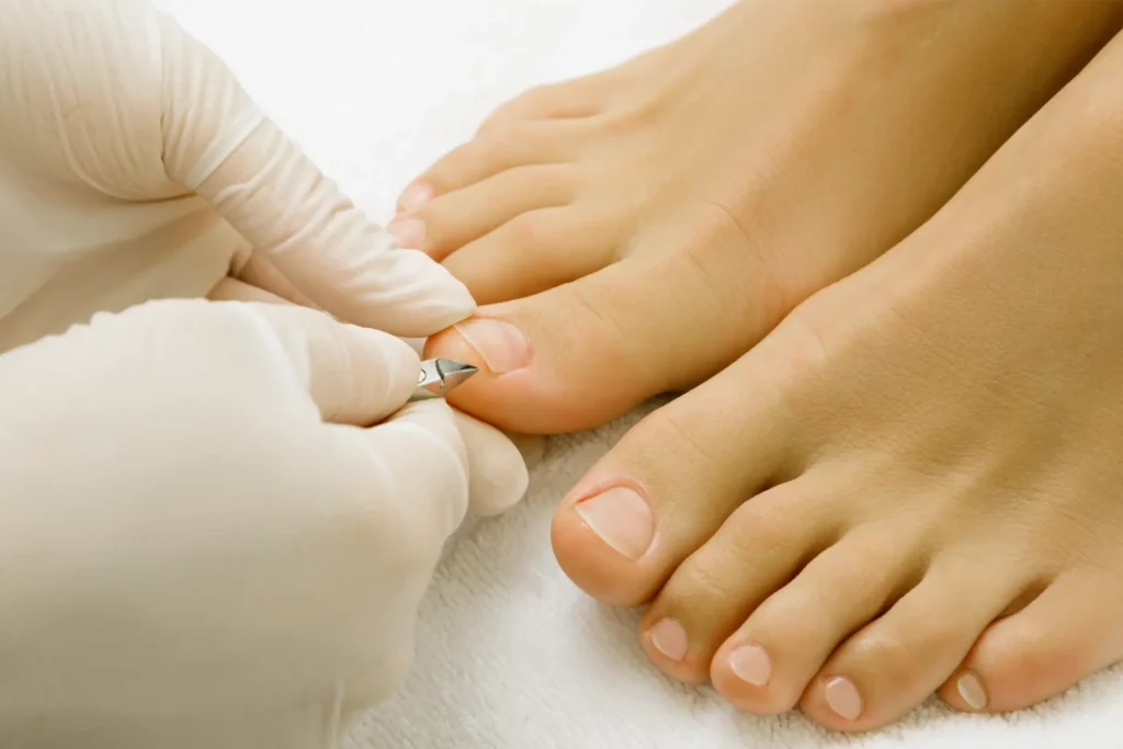 Fungal Nail Issues 1 pedicure master work close up of female nails and 2024 10 18 03 28 51 utc 1