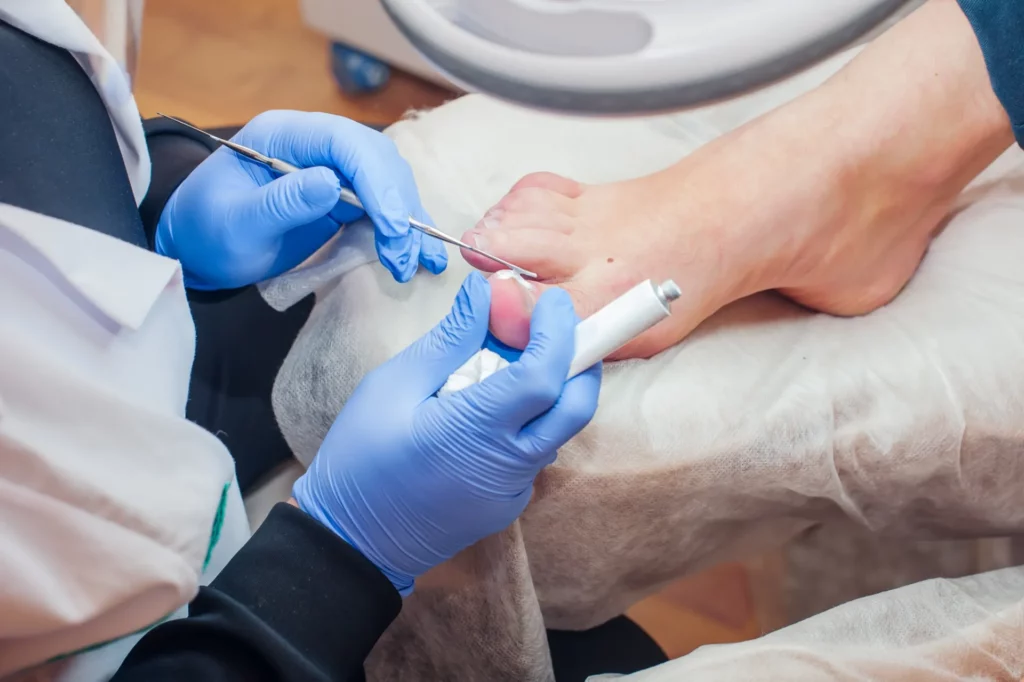 podology treatment podiatrist treating toenail fu 2022 11 15 16 57 24 utc