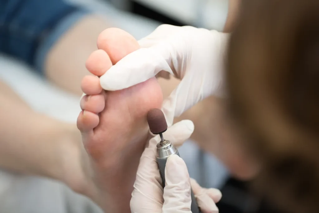 Planter Fasciitis 1 process pedicure close up polishing feet 2025 01 10 20 41 14 utc